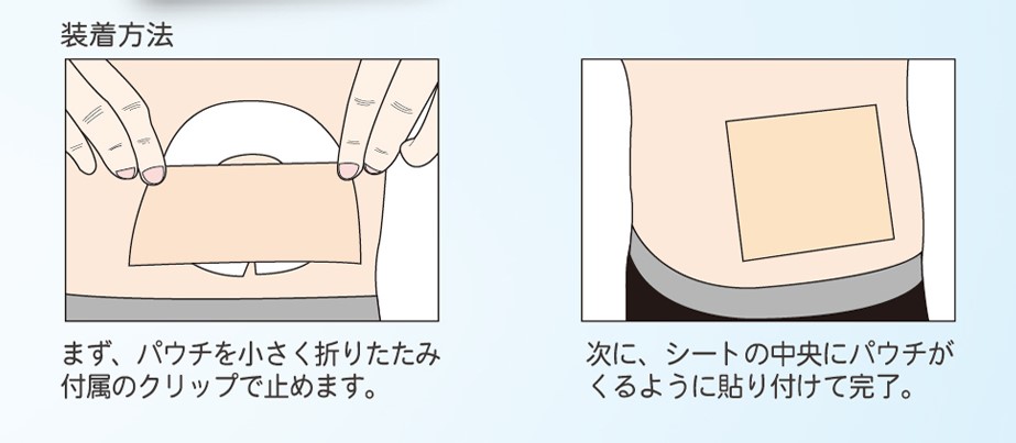 ストーマのある暮らしガイド ～入浴編～ | スタッフブログ
